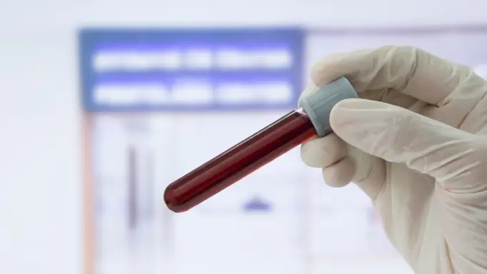 DUI Blood Draw | Fort Lauderdale, Florida | Michael White P.A.